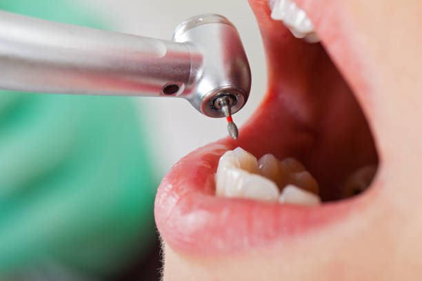 Best Broken or Cracked Tooth Emergency Dentist in Meadowood, PA